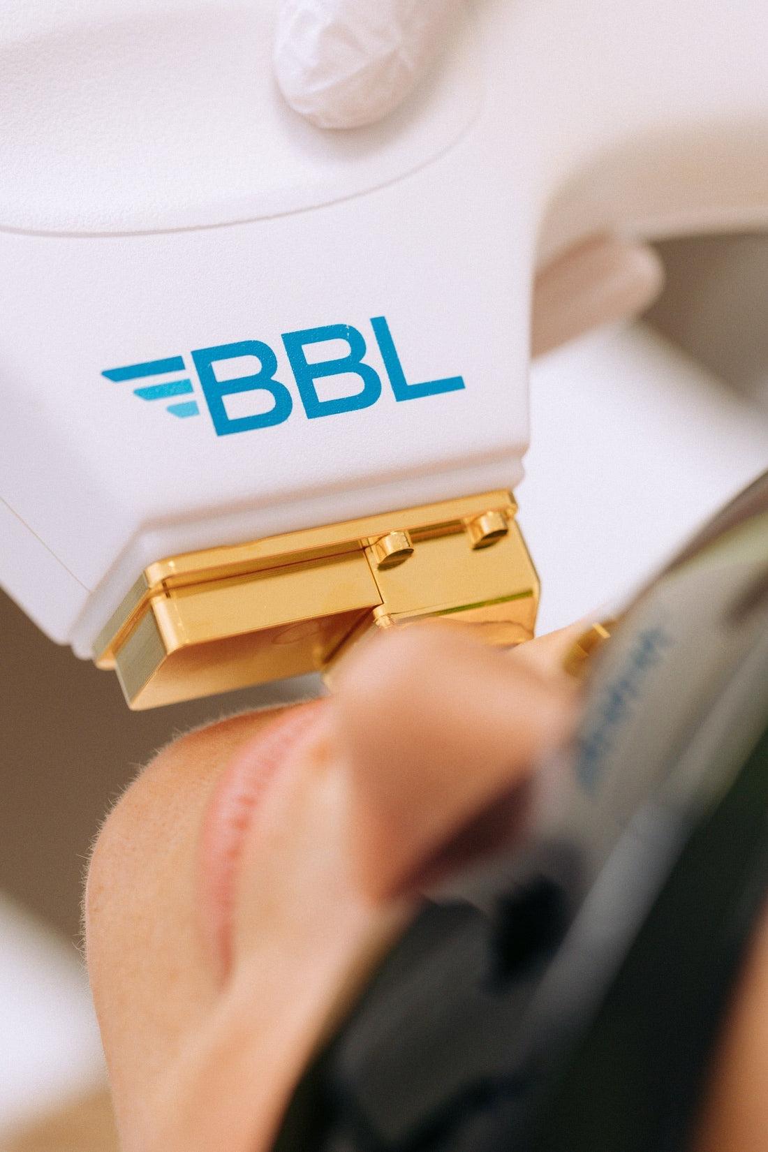 Close-up of a BBL (BroadBand Light) device being used during a cosmetic treatment on a patient’s face, highlighting the precision applicator and branded device head.
