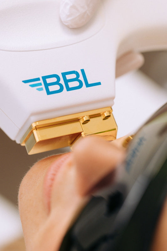 Close-up of a BBL (BroadBand Light) device being used during a cosmetic treatment on a patient’s face, highlighting the precision applicator and branded device head.
