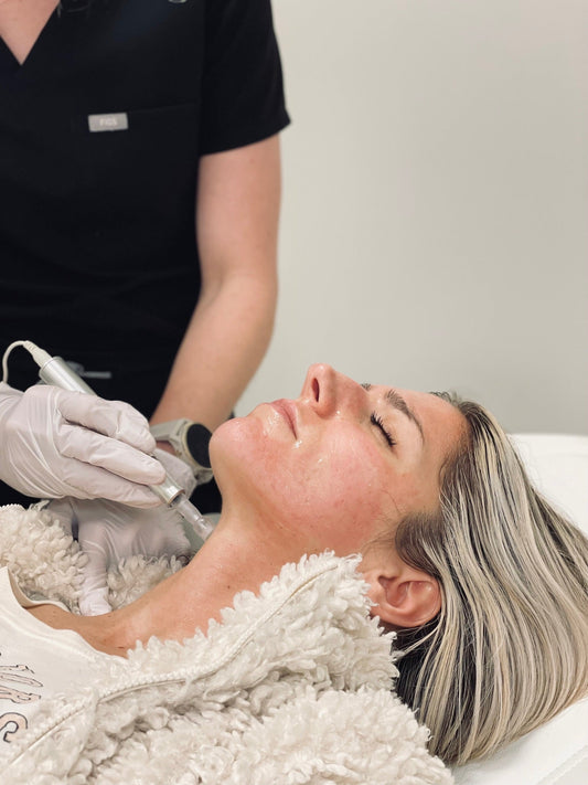 Woman receiving microneedling