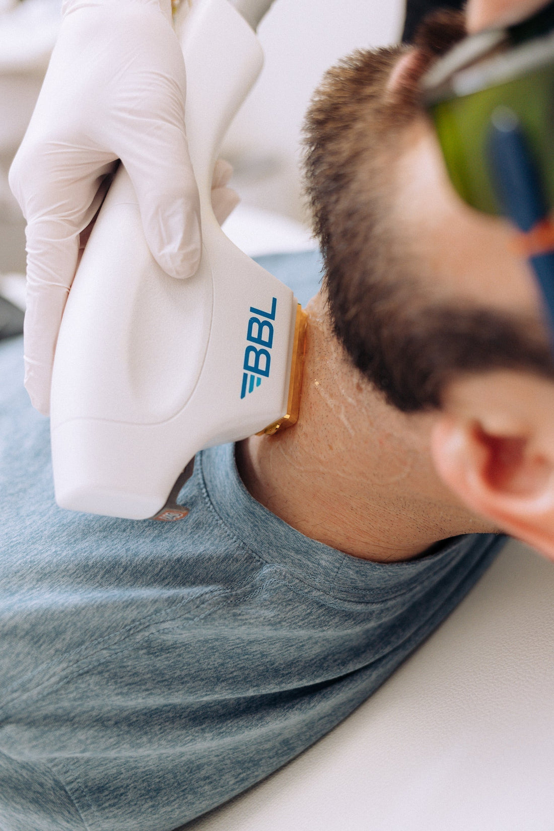 A nurse practitioner performs BBL Hero laser hair removal on a patient’s neck using a BroadBand Light device at Hi, Finch.
