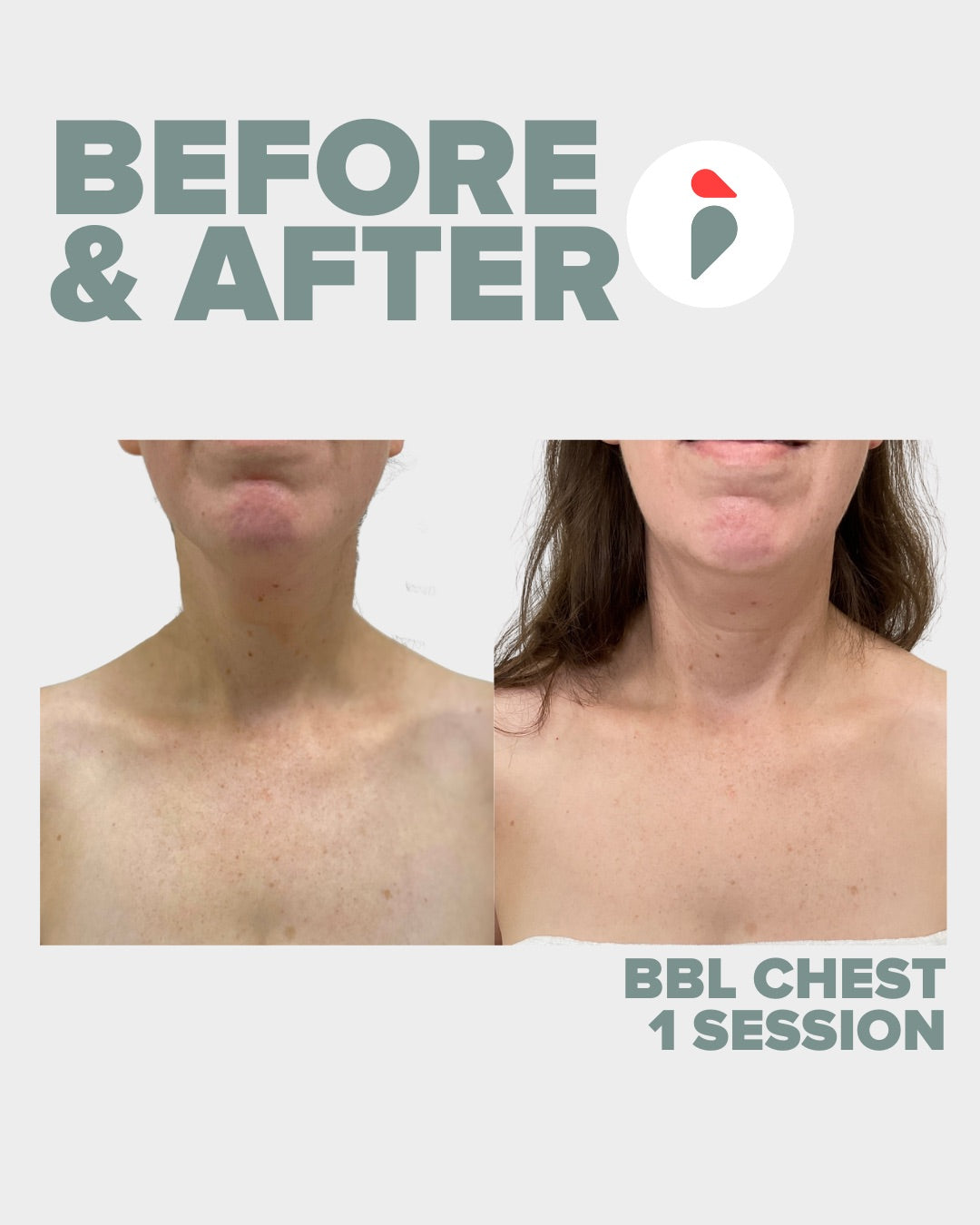 BBL Hero Chest – Nashville patient