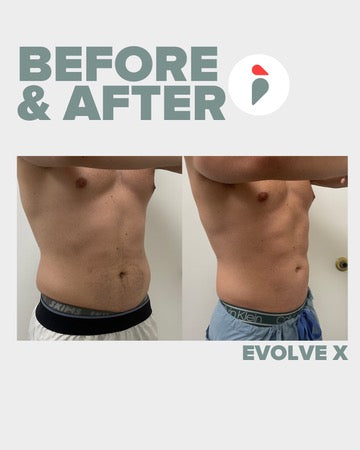 Evolve X – Nashville patient