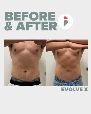 Evolve X – Nashville patient