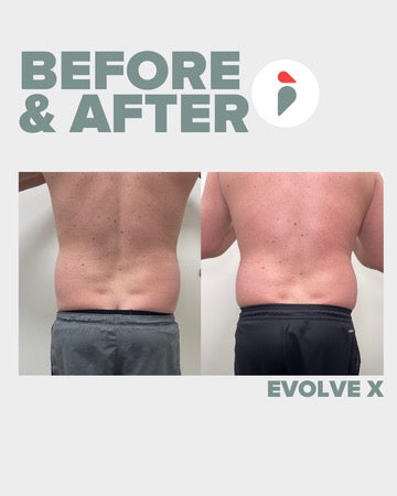 Evolve X – Nashville patient